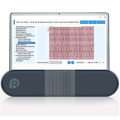 2023 Wellue EKG Monitor: Präziser Herztracker im Test